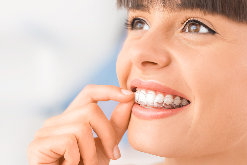 Invisalign in Edinburg