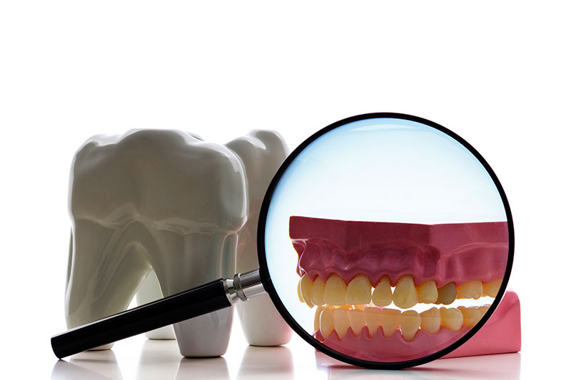 Root Canal Treatment in Edinburg