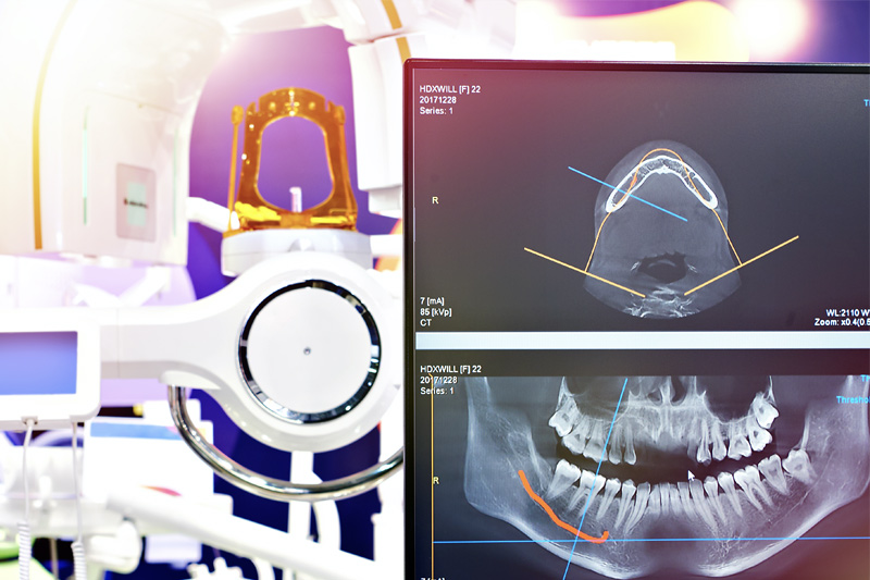 Digital X-Rays in Edinburg